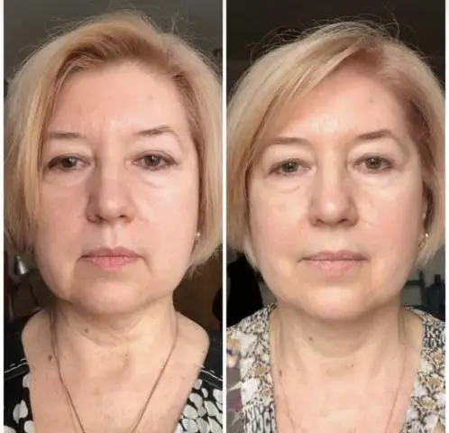 Коллаген жидкий морской 10000 мг collagen peptides