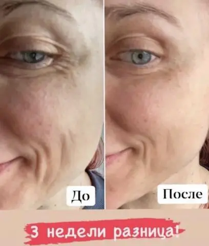 Коллаген жидкий морской 10000 мг collagen peptides